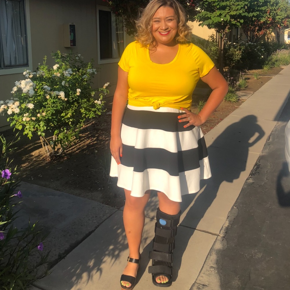 Black and white striped skirt with elastic waist